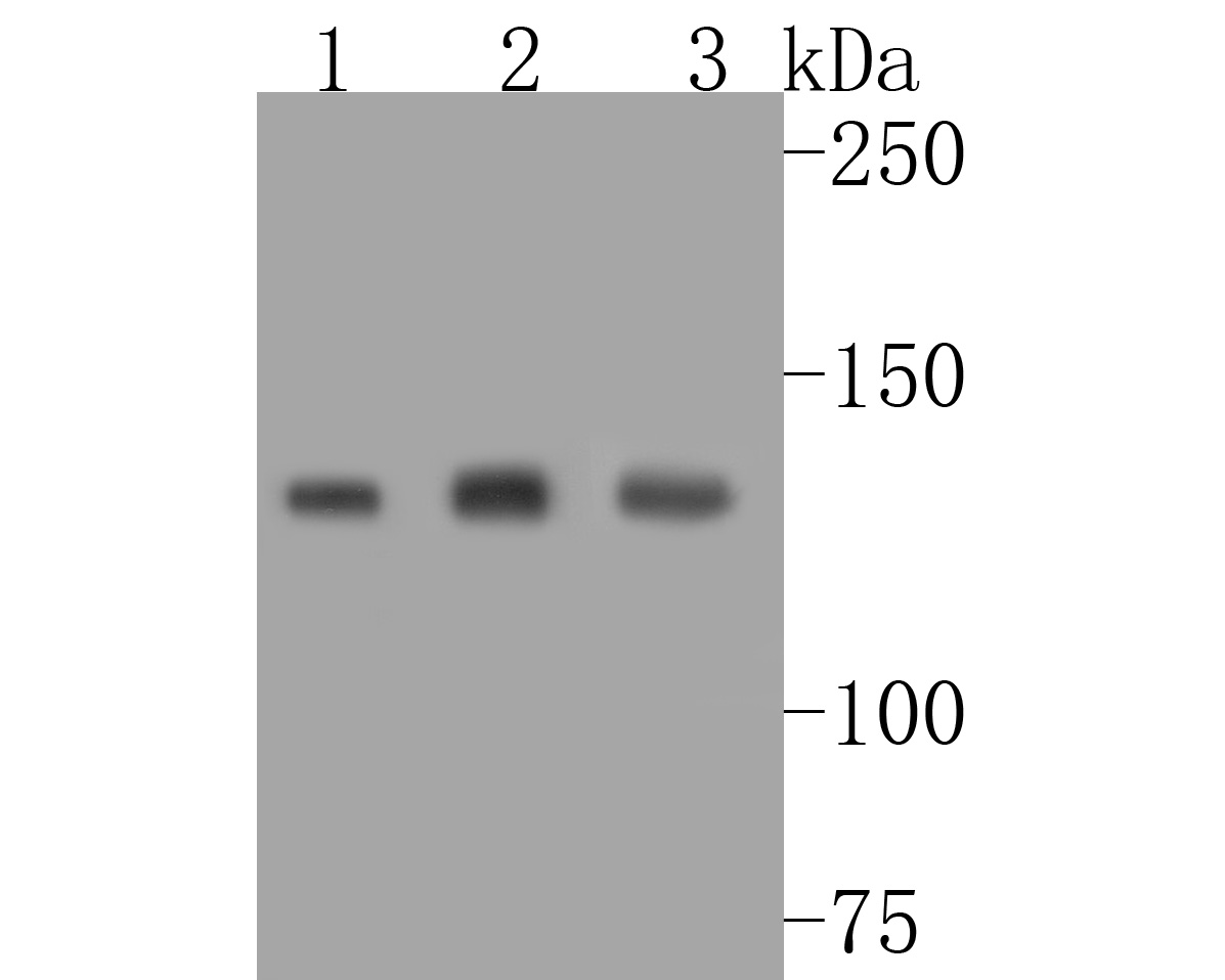 Western blot analysis of UBE4B on different lysates. Proteins were transferred to a PVDF membrane and blocked with 5% BSA in PBS for 1 hour at room temperature. The primary antibody (ET7111-11, 1/1,000) was used in 5% BSA at room temperature for 2 hours. Goat Anti-Rabbit IgG - HRP Secondary Antibody (HA1001) at 1:5,000 dilution was used for 1 hour at room temperature.<br />
Positive control: <br />
Lane 1: HepG2 cell lysate<br />
Lane 2: NIH/3T3 cell lysate<br />
Lane 3: PC-12 cell lysate