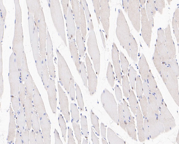 Immunohistochemical analysis of paraffin-embedded rat skeletal muscle tissue with Rabbit anti-UBE4B antibody (ET7111-11) at 1/50 dilution.<br />
<br />
The section was pre-treated using heat mediated antigen retrieval with sodium citrate buffer (pH 6.0) for 2 minutes. The tissues were blocked in 1% BSA for 20 minutes at room temperature, washed with ddH2O and PBS, and then probed with the primary antibody (ET7111-11) at 1/50 dilution for 1 hour at room temperature. The detection was performed using an HRP conjugated compact polymer system. DAB was used as the chromogen. Tissues were counterstained with hematoxylin and mounted with DPX.