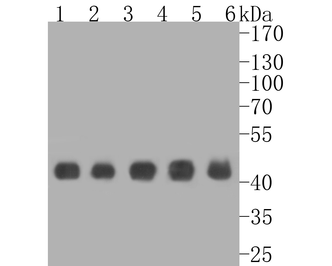 Western blot analysis of PGD on different lysates. Proteins were transferred to a PVDF membrane and blocked with 5% BSA in PBS for 1 hour at room temperature. The primary antibody (ET7111-12, 1/1,000) was used in 5% BSA at room temperature for 2 hours. Goat Anti-Rabbit IgG - HRP Secondary Antibody (HA1001) at 1:5,000 dilution was used for 1 hour at room temperature.<br />
Positive control: <br />
Lane 1: Mouse liver tissue lysate<br />
Lane 2: Mouse placenta tissue lysate<br />
Lane 3: Rat spleen tissue lysate<br />
Lane 4: Rat testis tissue lysate<br />
Lane 5: Mouse brain tissue lysate