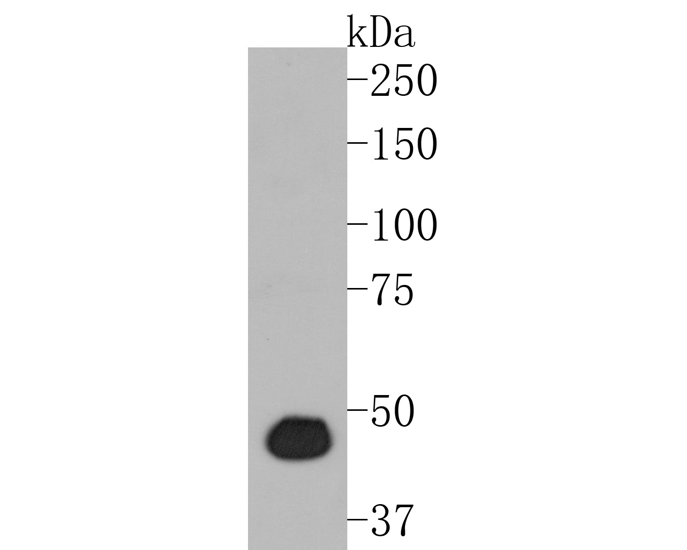 Western blot analysis of PGD on zebrafish tissue lysates. Proteins were transferred to a PVDF membrane and blocked with 5% BSA in PBS for 1 hour at room temperature. The primary antibody (ET7111-12, 1/500) was used in 5% BSA at room temperature for 2 hours. Goat Anti-Rabbit IgG - HRP Secondary Antibody (HA1001) at 1:5,000 dilution was used for 1 hour at room temperature.