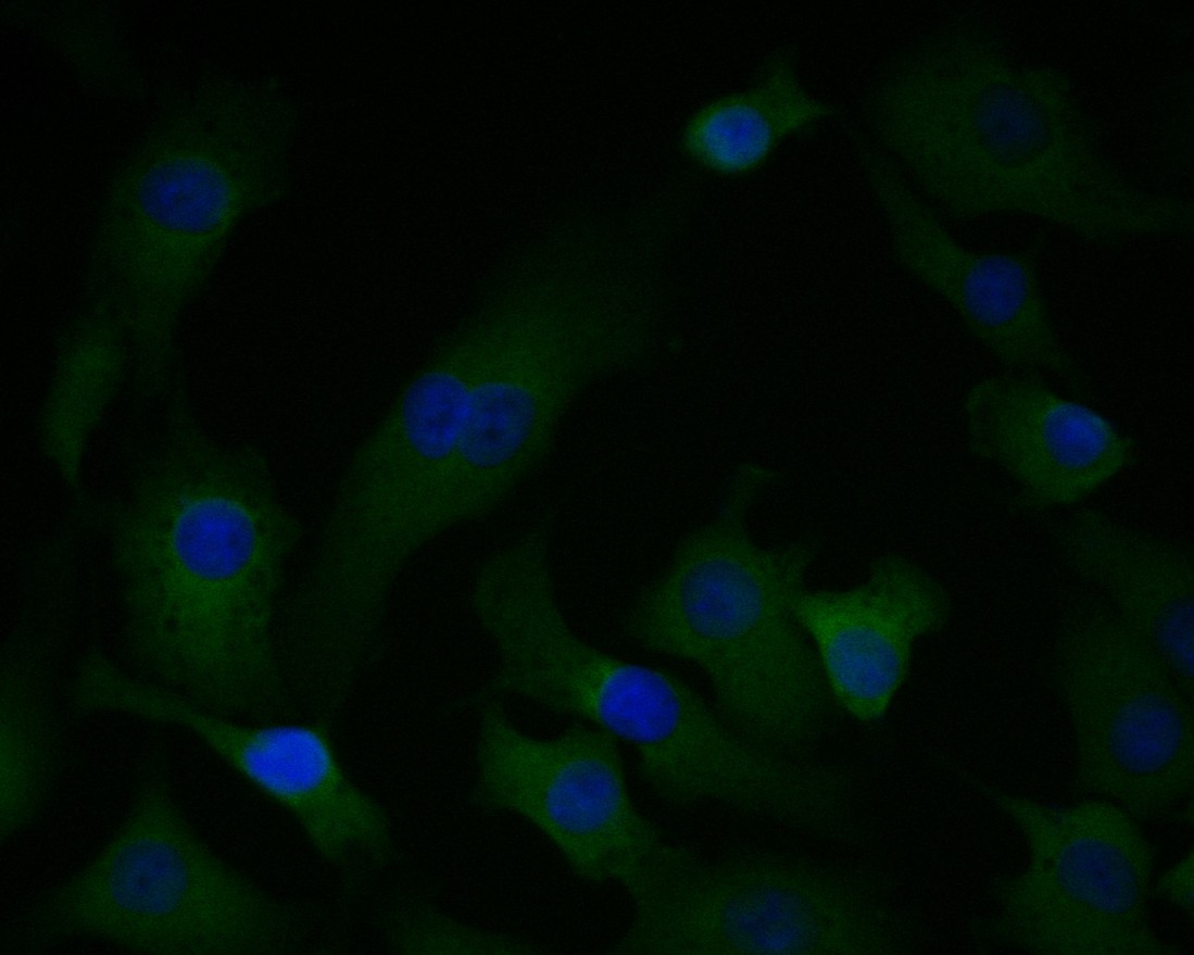 ICC staining of PGD in A549 cells (green). Formalin fixed cells were permeabilized with 0.1% Triton X-100 in TBS for 10 minutes at room temperature and blocked with 1% Blocker BSA for 15 minutes at room temperature. Cells were probed with the primary antibody (ET7111-12, 1/50) for 1 hour at room temperature, washed with PBS. Alexa Fluor®488 Goat anti-Rabbit IgG was used as the secondary antibody at 1/1,000 dilution. The nuclear counter stain is DAPI (blue).