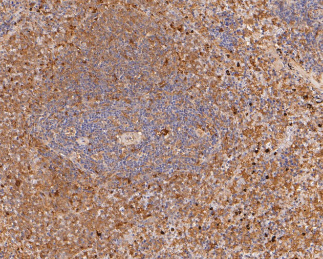 Immunohistochemical analysis of paraffin-embedded rat spleen tissue using anti-PGD antibody. The section was pre-treated using heat mediated antigen retrieval with Tris-EDTA buffer (pH 8.0-8.4) for 20 minutes.The tissues were blocked in 5% BSA for 30 minutes at room temperature, washed with ddH2O and PBS, and then probed with the primary antibody (ET7111-12, 1/50) for 30 minutes at room temperature. The detection was performed using an HRP conjugated compact polymer system. DAB was used as the chromogen. Tissues were counterstained with hematoxylin and mounted with DPX.