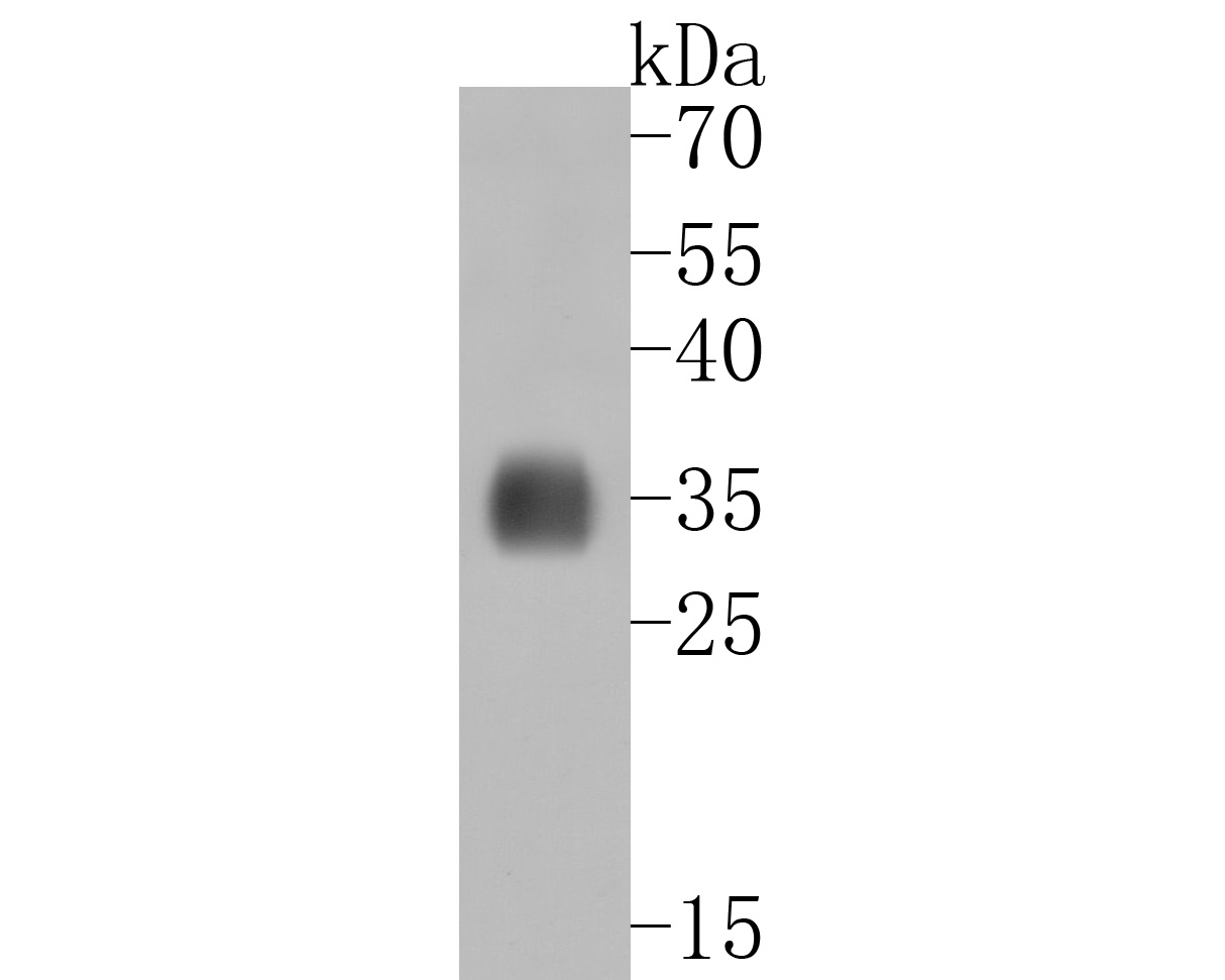 Western blot analysis of RRP42 on zebrafish tissue lysates. Proteins were transferred to a PVDF membrane and blocked with 5% BSA in PBS for 1 hour at room temperature. The primary antibody (ET7111-13, 1/500) was used in 5% BSA at room temperature for 2 hours. Goat Anti-Rabbit IgG - HRP Secondary Antibody (HA1001) at 1:5,000 dilution was used for 1 hour at room temperature.