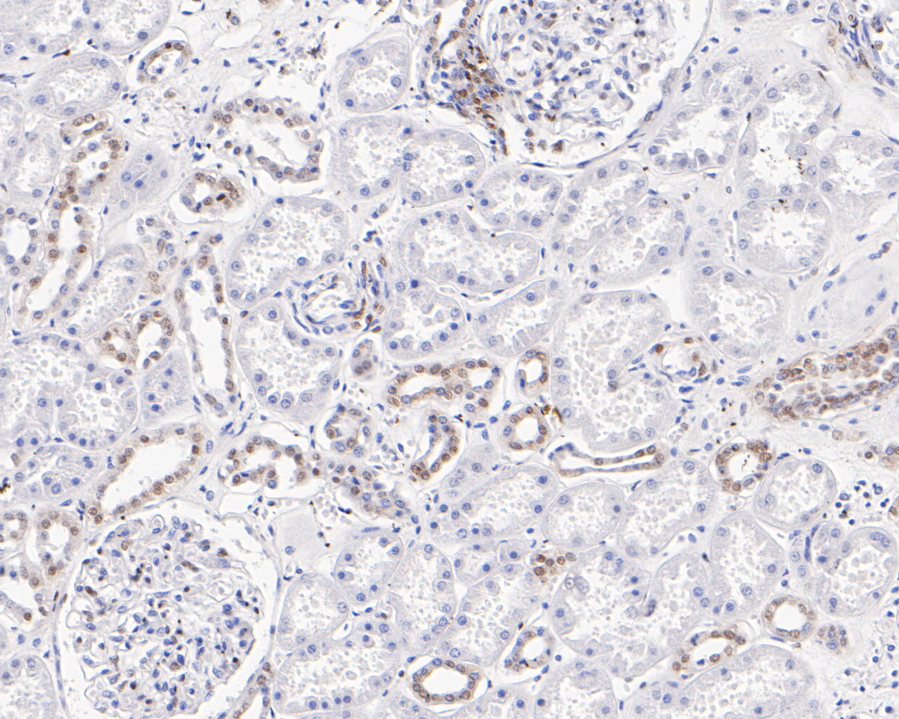 Immunohistochemical analysis of paraffin-embedded human kidney tissue using anti-CIRP antibody. The section was pre-treated using heat mediated antigen retrieval with sodium citrate buffer (pH 6.0) for 20 minutes. The tissues were blocked in 5% BSA for 30 minutes at room temperature, washed with ddH2O and PBS, and then probed with the primary antibody (ET7111-15, 1/200)  for 30 minutes at room temperature. The detection was performed using an HRP conjugated compact polymer system. DAB was used as the chromogen. Tissues were counterstained with hematoxylin and mounted with DPX.