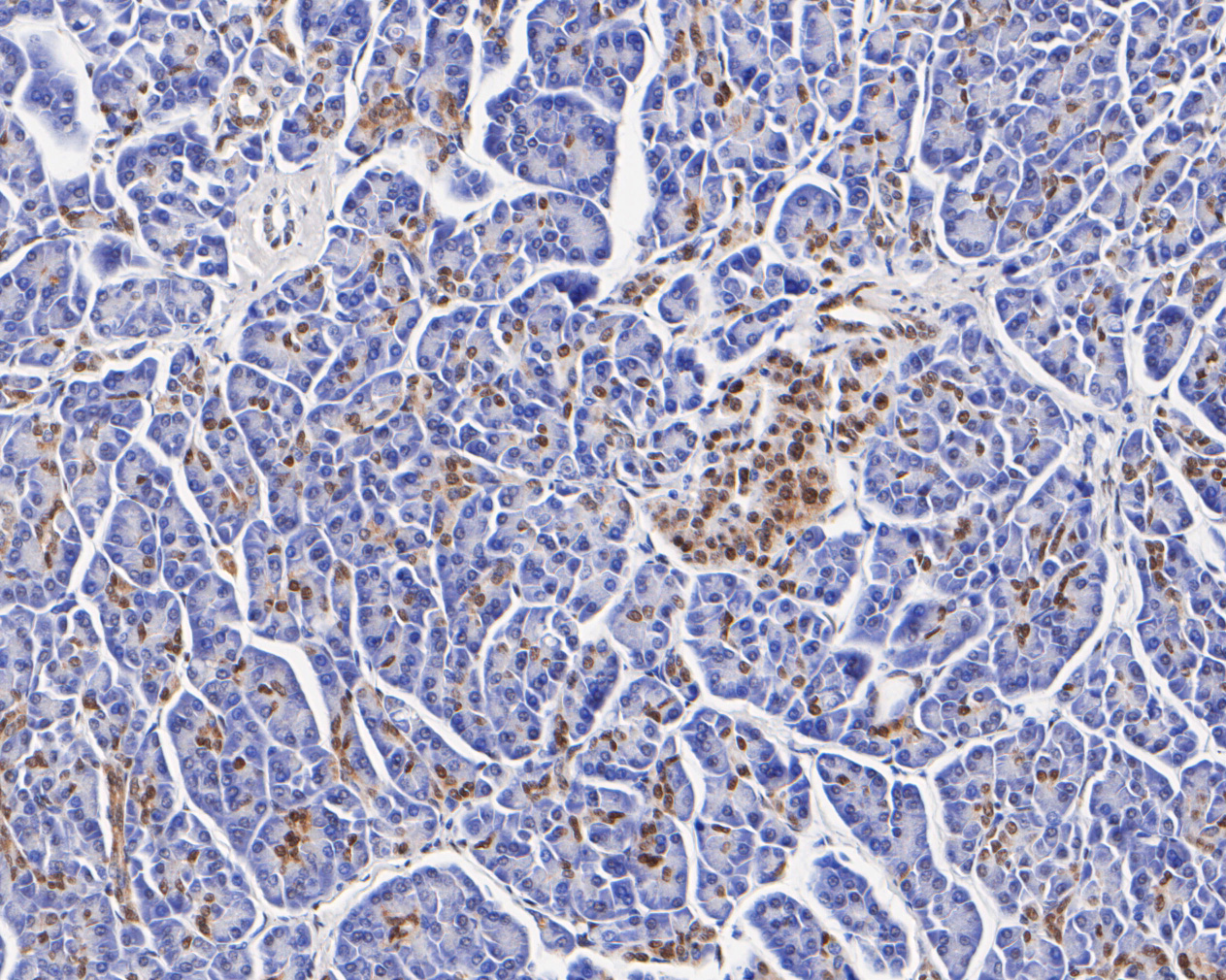 Immunohistochemical analysis of paraffin-embedded human pancreas tissue using anti-CIRP antibody. The section was pre-treated using heat mediated antigen retrieval with sodium citrate buffer (pH 6.0) for 20 minutes. The tissues were blocked in 5% BSA for 30 minutes at room temperature, washed with ddH2O and PBS, and then probed with the primary antibody (ET7111-15, 1/200)  for 30 minutes at room temperature. The detection was performed using an HRP conjugated compact polymer system. DAB was used as the chromogen. Tissues were counterstained with hematoxylin and mounted with DPX.