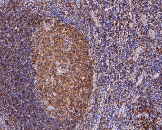 Immunohistochemical analysis of paraffin-embedded human tonsil tissue using anti-HLA-DRB4 antibody. The section was pre-treated using heat mediated antigen retrieval with Tris-EDTA buffer (pH 8.0-8.4) for 20 minutes.The tissues were blocked in 5% BSA for 30 minutes at room temperature, washed with ddH2O and PBS, and then probed with the primary antibody (ET7111-17, 1/200) for 30 minutes at room temperature. The detection was performed using an HRP conjugated compact polymer system. DAB was used as the chromogen. Tissues were counterstained with hematoxylin and mounted with DPX.