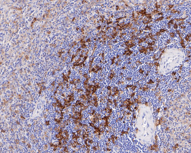 Immunohistochemical analysis of paraffin-embedded human spleen tissue using anti-HLA-DRB4 antibody. The section was pre-treated using heat mediated antigen retrieval with Tris-EDTA buffer (pH 8.0-8.4) for 20 minutes.The tissues were blocked in 5% BSA for 30 minutes at room temperature, washed with ddH2O and PBS, and then probed with the primary antibody (ET7111-17, 1/200) for 30 minutes at room temperature. The detection was performed using an HRP conjugated compact polymer system. DAB was used as the chromogen. Tissues were counterstained with hematoxylin and mounted with DPX.