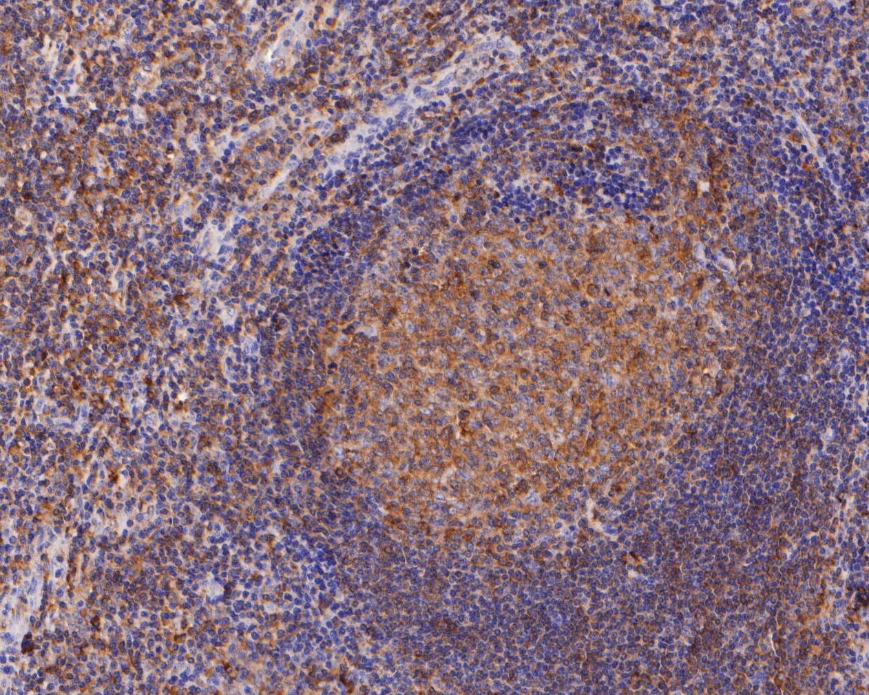 Immunohistochemical analysis of paraffin-embedded human tonsil tissue using anti-CARS antibody. The section was pre-treated using heat mediated antigen retrieval with Tris-EDTA buffer (pH 8.0-8.4) for 20 minutes.The tissues were blocked in 5% BSA for 30 minutes at room temperature, washed with ddH2O and PBS, and then probed with the primary antibody (ET7111-18, 1/50) for 30 minutes at room temperature. The detection was performed using an HRP conjugated compact polymer system. DAB was used as the chromogen. Tissues were counterstained with hematoxylin and mounted with DPX.