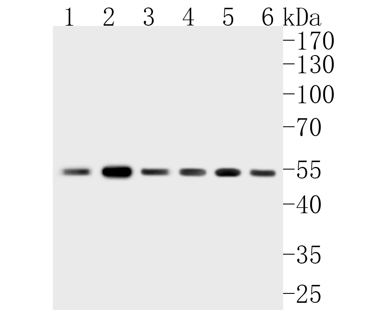 Western blot analysis of FADS1 on different lysates. Proteins were transferred to a PVDF membrane and blocked with 5% BSA in PBS for 1 hour at room temperature. The primary antibody (ET7111-19, 1/1,000) was used in 5% BSA at room temperature for 2 hours. Goat Anti-Rabbit IgG - HRP Secondary Antibody (HA1001) at 1:5,000 dilution was used for 1 hour at room temperature.<br />
Positive control: <br />
Lane 1: rat liver tissue lysate<br />
Lane 2: mouse liver tissue lysate<br />
Lane 3: mouse brain tissue lysate<br />
Lane 4: rat lung tissue lysate<br />
Lane 5: Hela cell lysate<br />
Lane 6: A549 cell lysate