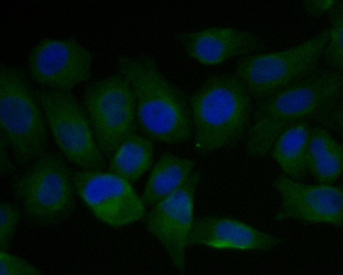 ICC staining of FADS1 in Hela cells (green). Formalin fixed cells were permeabilized with 0.1% Triton X-100 in TBS for 10 minutes at room temperature and blocked with 1% Blocker BSA for 15 minutes at room temperature. Cells were probed with the primary antibody (ET7111-19, 1/50) for 1 hour at room temperature, washed with PBS. Alexa Fluor®488 Goat anti-Rabbit IgG was used as the secondary antibody at 1/1,000 dilution. The nuclear counter stain is DAPI (blue).