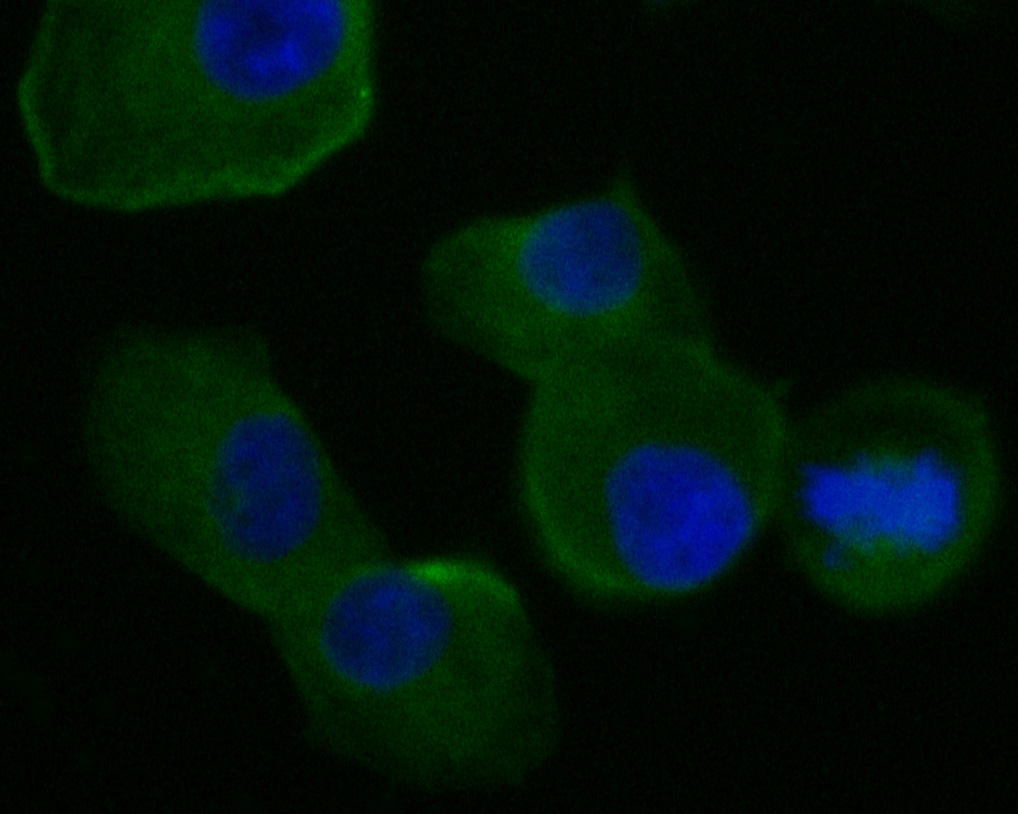 ICC staining of FADS1 in PANC-1 cells (green). Formalin fixed cells were permeabilized with 0.1% Triton X-100 in TBS for 10 minutes at room temperature and blocked with 1% Blocker BSA for 15 minutes at room temperature. Cells were probed with the primary antibody (ET7111-19, 1/50) for 1 hour at room temperature, washed with PBS. Alexa Fluor®488 Goat anti-Rabbit IgG was used as the secondary antibody at 1/1,000 dilution. The nuclear counter stain is DAPI (blue).