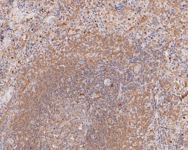 Immunohistochemical analysis of paraffin-embedded rat spleen tissue using anti-Themis antibody. The section was pre-treated using heat mediated antigen retrieval with sodium citrate buffer (pH 6.0) for 20 minutes. The tissues were blocked in 5% BSA for 30 minutes at room temperature, washed with ddH2O and PBS, and then probed with the primary antibody (ET7111-20, 1/50)  for 30 minutes at room temperature. The detection was performed using an HRP conjugated compact polymer system. DAB was used as the chromogen. Tissues were counterstained with hematoxylin and mounted with DPX.
