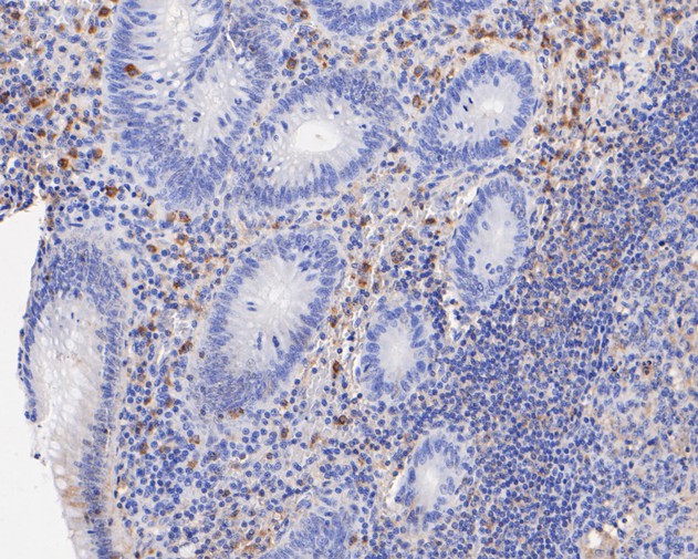 Immunohistochemical analysis of paraffin-embedded human appendix tissue using anti-Themis antibody. The section was pre-treated using heat mediated antigen retrieval with sodium citrate buffer (pH 6.0) for 20 minutes. The tissues were blocked in 5% BSA for 30 minutes at room temperature, washed with ddH2O and PBS, and then probed with the primary antibody (ET7111-20, 1/50)  for 30 minutes at room temperature. The detection was performed using an HRP conjugated compact polymer system. DAB was used as the chromogen. Tissues were counterstained with hematoxylin and mounted with DPX.