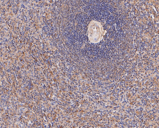 Immunohistochemical analysis of paraffin-embedded human spleen tissue using anti-Themis antibody. The section was pre-treated using heat mediated antigen retrieval with sodium citrate buffer (pH 6.0) for 20 minutes. The tissues were blocked in 5% BSA for 30 minutes at room temperature, washed with ddH2O and PBS, and then probed with the primary antibody (ET7111-20, 1/50)  for 30 minutes at room temperature. The detection was performed using an HRP conjugated compact polymer system. DAB was used as the chromogen. Tissues were counterstained with hematoxylin and mounted with DPX.