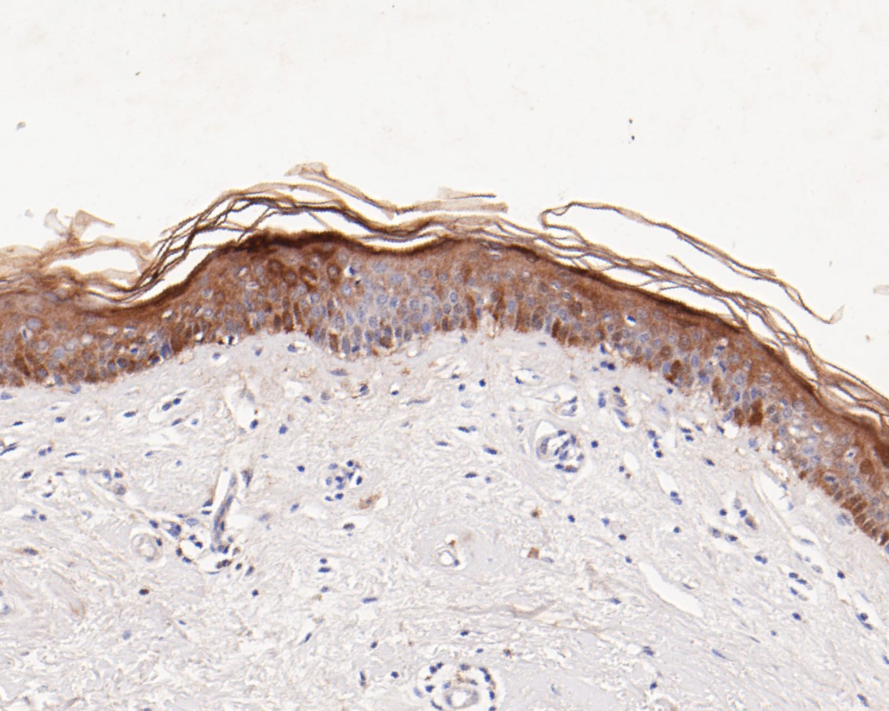 Immunohistochemical analysis of paraffin-embedded human skin tissue using anti-SerpinB3 antibody. The section was pre-treated using heat mediated antigen retrieval with Tris-EDTA buffer (pH 8.0-8.4) for 20 minutes.The tissues were blocked in 5% BSA for 30 minutes at room temperature, washed with ddH2O and PBS, and then probed with the primary antibody (ET7111-21, 1/50) for 30 minutes at room temperature. The detection was performed using an HRP conjugated compact polymer system. DAB was used as the chromogen. Tissues were counterstained with hematoxylin and mounted with DPX.