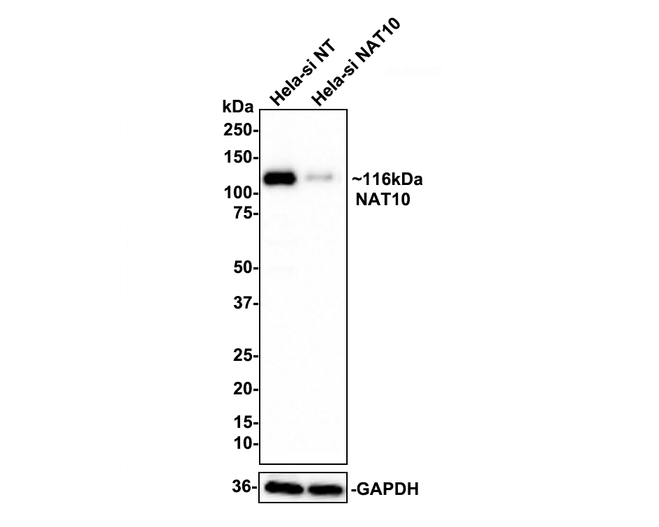 Western blot analysis of NAT10 on different lysates with Rabbit anti-NAT10 antibody (ET7111-23) at 1/500 dilution.<br />
<br />
Lane 1: Hela-si NT cell lysate<br />
Lane 2: Hela-si NAT10 cell lysate<br />
<br />
Lysates/proteins at 10 µg/Lane.<br />
<br />
Predicted band size: 116 kDa<br />
Observed band size: 116 kDa<br />
<br />
Exposure time: 1 minute;<br />
<br />
4-20% SDS-PAGE gel.<br />
<br />
ET7111-23 was shown to specifically react with NAT10 in Hela-si NT cells. Weakened band was observed when Hela-si NAT10 sample was tested. Hela-si NT and Hela-si NAT10 samples were subjected to SDS-PAGE. Proteins were transferred to a PVDF membrane and blocked with 5% NFDM in TBST for 1 hour at room temperature. The primary antibody (ET7111-23, 1/500) and Loading control antibody (Rabbit anti-GAPDH, ET1601-4, 1/10,000) were used in 5% BSA at room temperature for 2 hours. Goat Anti-rabbit IgG-HRP Secondary Antibody (HA1001) at 1:100,000 dilution was used for 1 hour at room temperature.