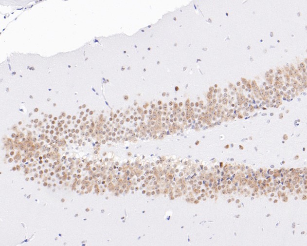 Immunohistochemical analysis of paraffin-embedded mouse brain tissue using anti-NAT10 antibody. The section was pre-treated using heat mediated antigen retrieval with sodium citrate buffer (pH 6.0) for 20 minutes. The tissues were blocked in 5% BSA for 30 minutes at room temperature, washed with ddH2O and PBS, and then probed with the primary antibody (ET7111-23, 1/200)  for 30 minutes at room temperature. The detection was performed using an HRP conjugated compact polymer system. DAB was used as the chromogen. Tissues were counterstained with hematoxylin and mounted with DPX.
