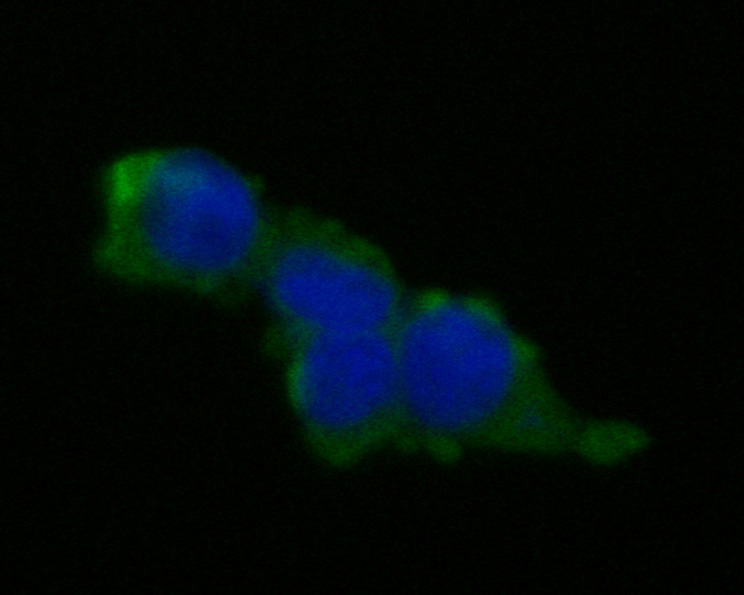ICC staining of Desmocollin 3 in 293T cells (green). Formalin fixed cells were permeabilized with 0.1% Triton X-100 in TBS for 10 minutes at room temperature and blocked with 1% Blocker BSA for 15 minutes at room temperature. Cells were probed with the primary antibody (ET7111-26, 1/50) for 1 hour at room temperature, washed with PBS. Alexa Fluor®488 Goat anti-Rabbit IgG was used as the secondary antibody at 1/1,000 dilution. The nuclear counter stain is DAPI (blue).