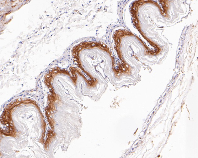 Immunohistochemical analysis of paraffin-embedded mouse esophagus tissue using anti-Desmocollin 3 antibody. The section was pre-treated using heat mediated antigen retrieval with Tris-EDTA buffer (pH 8.0-8.4) for 20 minutes.The tissues were blocked in 5% BSA for 30 minutes at room temperature, washed with ddH2O and PBS, and then probed with the primary antibody (ET7111-26, 1/200) for 30 minutes at room temperature. The detection was performed using an HRP conjugated compact polymer system. DAB was used as the chromogen. Tissues were counterstained with hematoxylin and mounted with DPX.