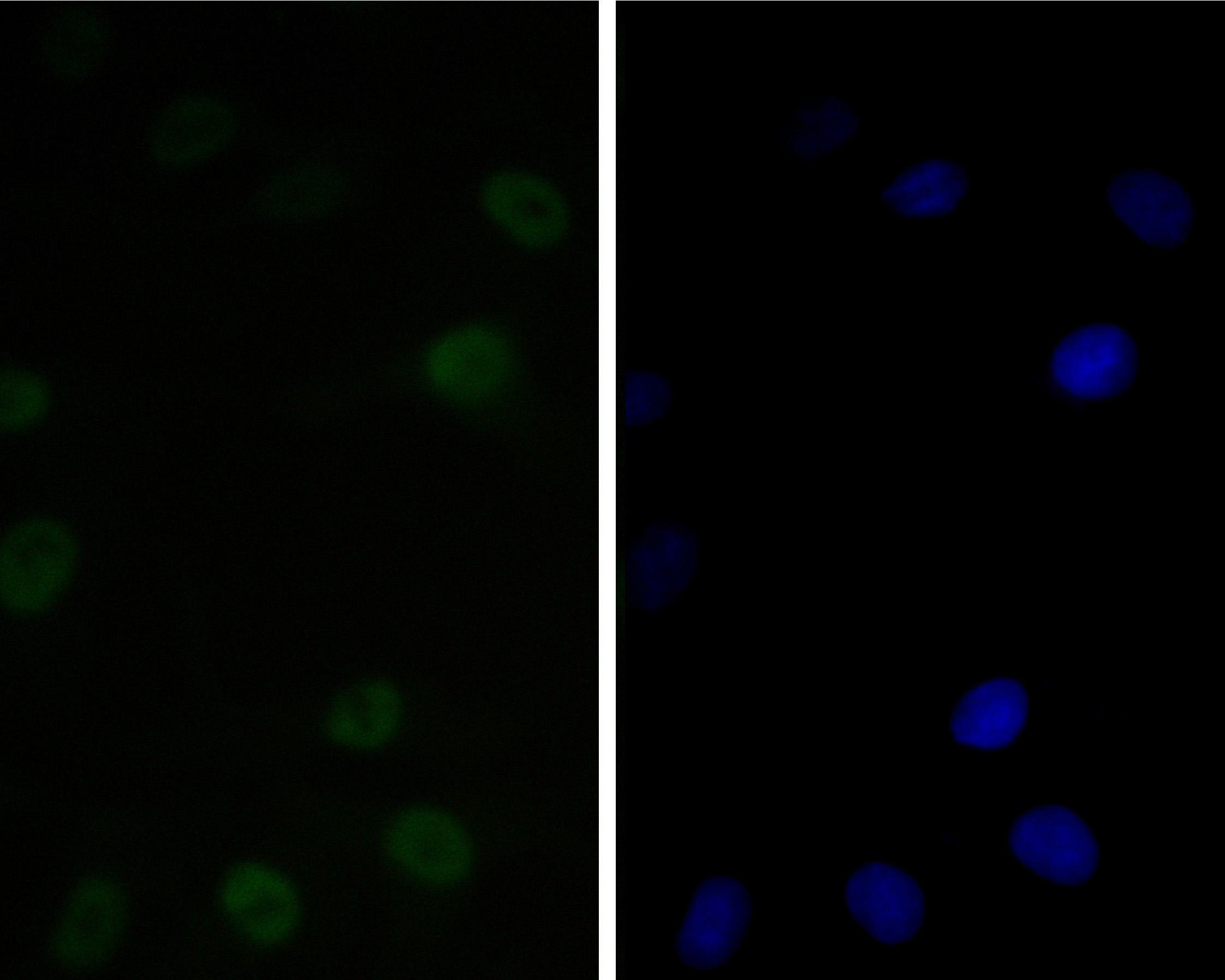 ICC staining of CTBP2 in A549 cells (green). Formalin fixed cells were permeabilized with 0.1% Triton X-100 in TBS for 10 minutes at room temperature and blocked with 1% Blocker BSA for 15 minutes at room temperature. Cells were probed with the primary antibody (ET7111-27, 1/50) for 1 hour at room temperature, washed with PBS. Alexa Fluor®488 Goat anti-Rabbit IgG was used as the secondary antibody at 1/1,000 dilution. The nuclear counter stain is DAPI (blue).