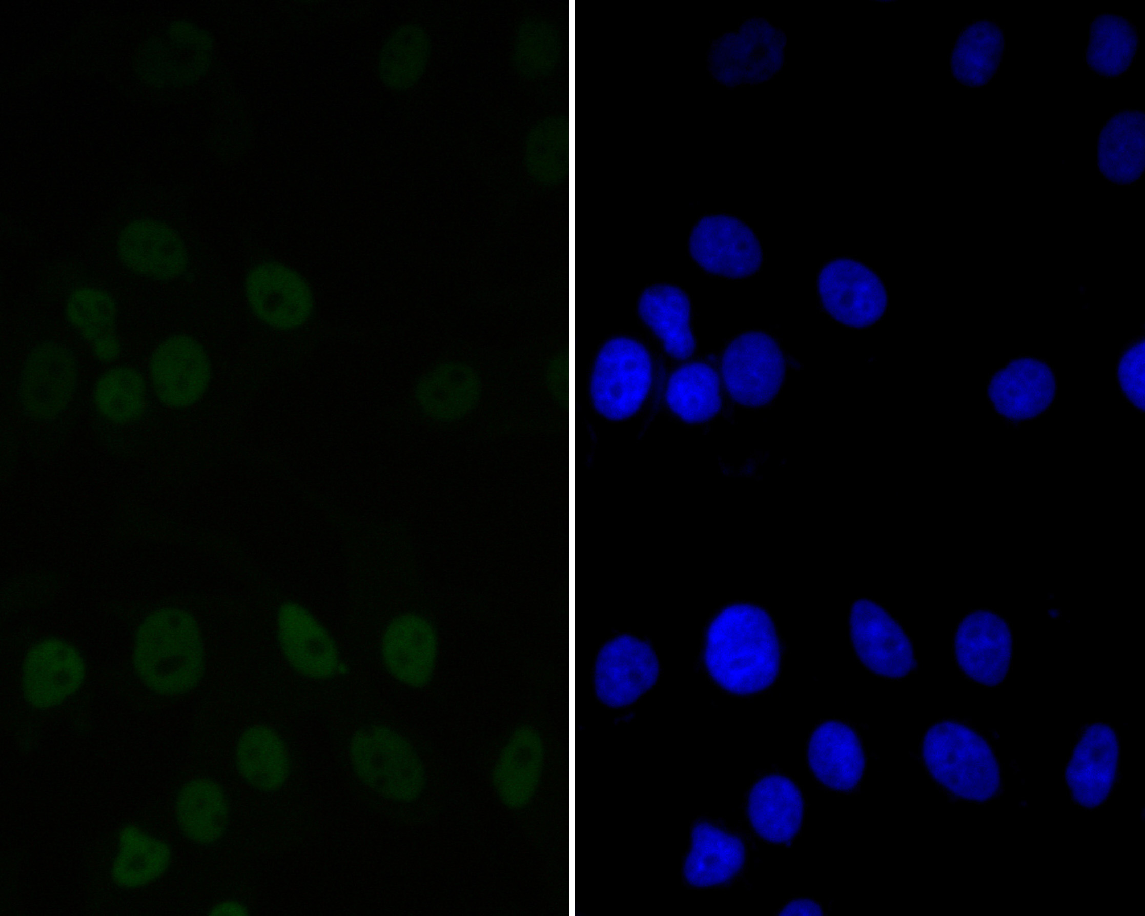 ICC staining of CTBP2 in MCF-7 cells (green). Formalin fixed cells were permeabilized with 0.1% Triton X-100 in TBS for 10 minutes at room temperature and blocked with 1% Blocker BSA for 15 minutes at room temperature. Cells were probed with the primary antibody (ET7111-27, 1/50) for 1 hour at room temperature, washed with PBS. Alexa Fluor®488 Goat anti-Rabbit IgG was used as the secondary antibody at 1/1,000 dilution. The nuclear counter stain is DAPI (blue).