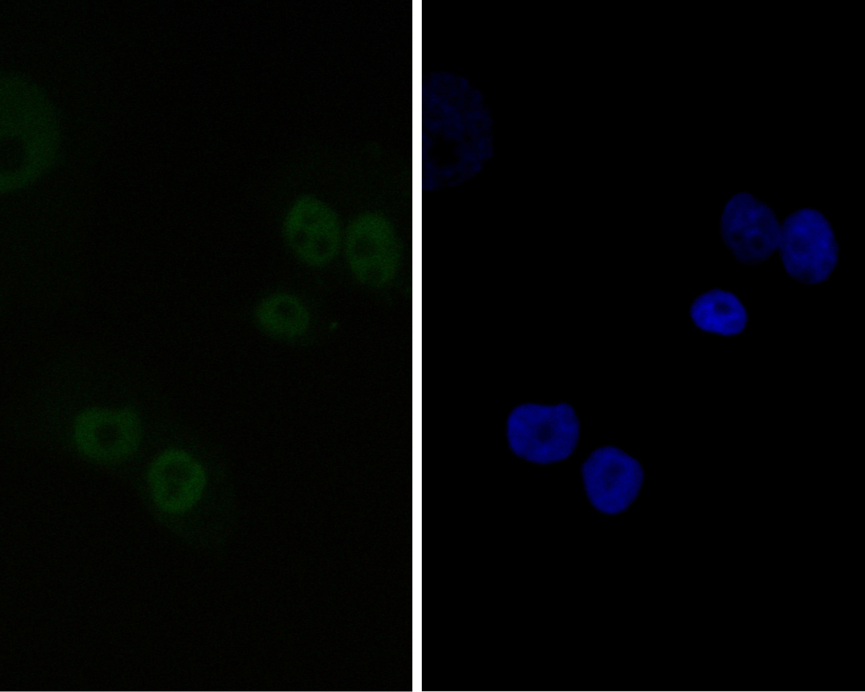 ICC staining of CTBP2 in PANC-1 cells (green). Formalin fixed cells were permeabilized with 0.1% Triton X-100 in TBS for 10 minutes at room temperature and blocked with 1% Blocker BSA for 15 minutes at room temperature. Cells were probed with the primary antibody (ET7111-27, 1/50) for 1 hour at room temperature, washed with PBS. Alexa Fluor®488 Goat anti-Rabbit IgG was used as the secondary antibody at 1/1,000 dilution. The nuclear counter stain is DAPI (blue).