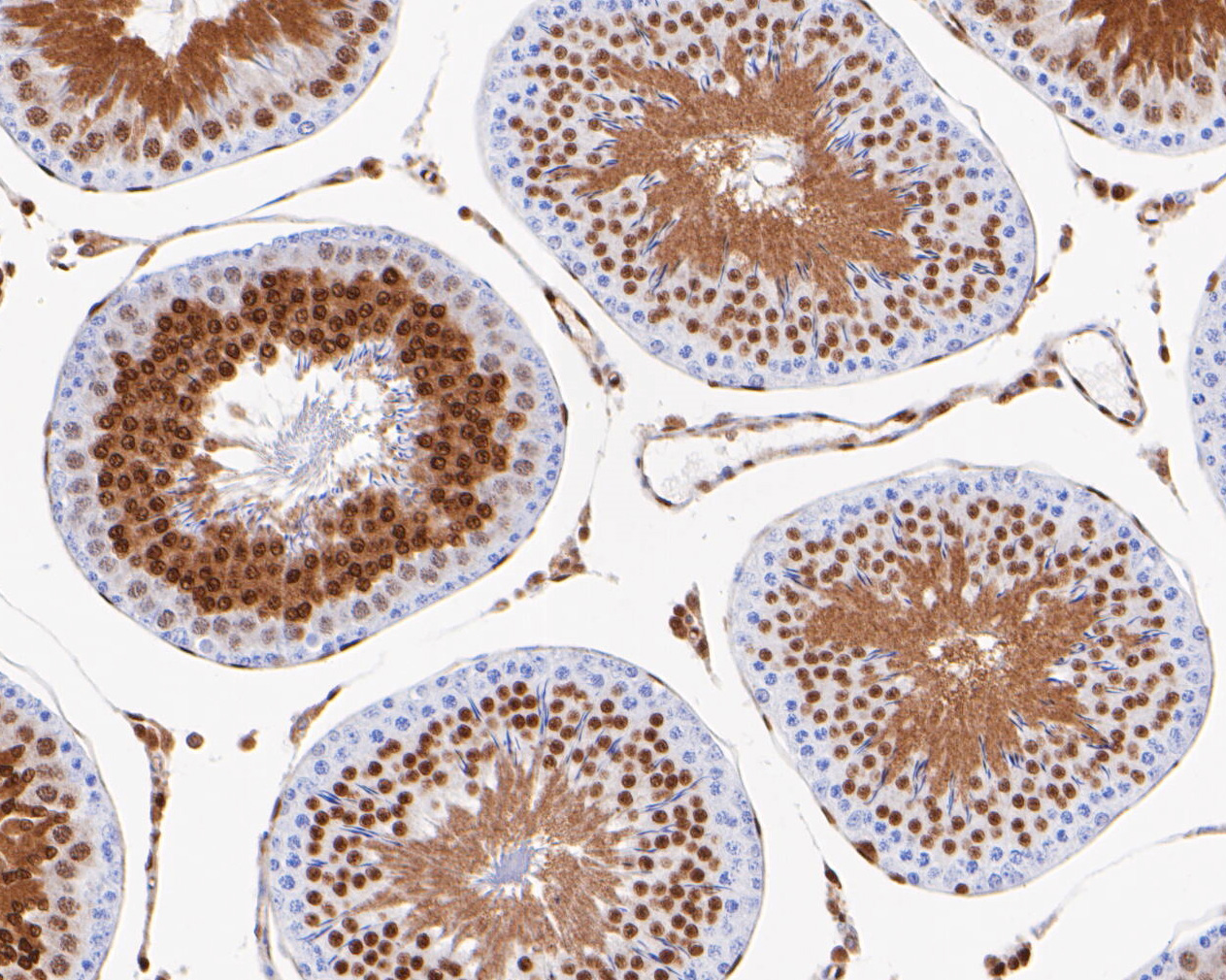 Immunohistochemical analysis of paraffin-embedded mouse testis tissue using anti-CTBP2 antibody. The section was pre-treated using heat mediated antigen retrieval with sodium citrate buffer (pH 6.0) for 20 minutes. The tissues were blocked in 5% BSA for 30 minutes at room temperature, washed with ddH2O and PBS, and then probed with the primary antibody (ET7111-27, 1/200)  for 30 minutes at room temperature. The detection was performed using an HRP conjugated compact polymer system. DAB was used as the chromogen. Tissues were counterstained with hematoxylin and mounted with DPX.