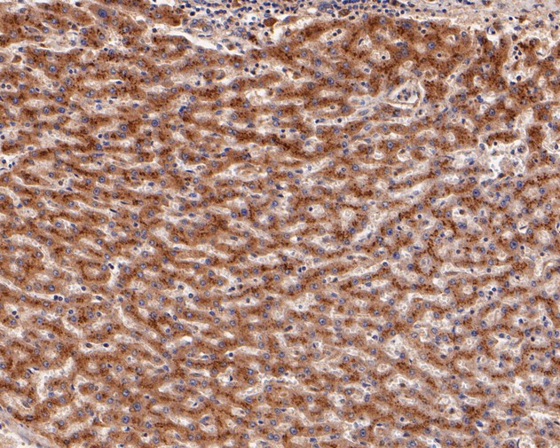 Immunohistochemical analysis of paraffin-embedded human liver tissue using anti-UCHL3 antibody. The section was pre-treated using heat mediated antigen retrieval with Tris-EDTA buffer (pH 8.0-8.4) for 20 minutes.The tissues were blocked in 5% BSA for 30 minutes at room temperature, washed with ddH2O and PBS, and then probed with the primary antibody (ET7111-28, 1/50) for 30 minutes at room temperature. The detection was performed using an HRP conjugated compact polymer system. DAB was used as the chromogen. Tissues were counterstained with hematoxylin and mounted with DPX.