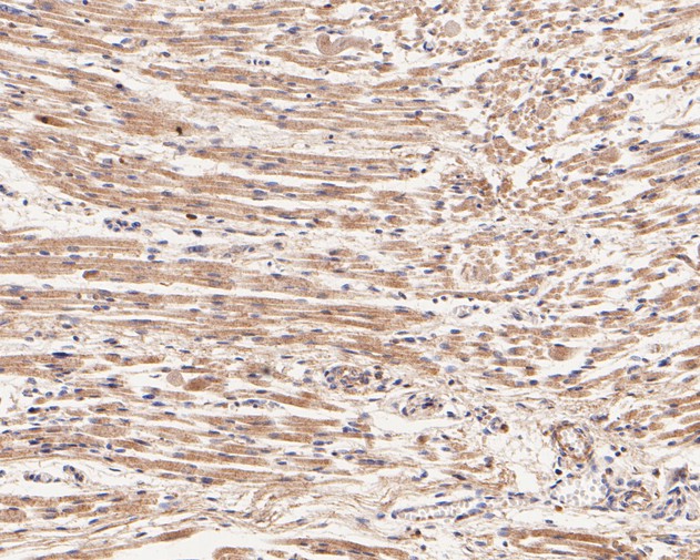 Immunohistochemical analysis of paraffin-embedded human fetal skeletal muscle tissue using anti-UCHL3 antibody. The section was pre-treated using heat mediated antigen retrieval with Tris-EDTA buffer (pH 8.0-8.4) for 20 minutes.The tissues were blocked in 5% BSA for 30 minutes at room temperature, washed with ddH2O and PBS, and then probed with the primary antibody (ET7111-28, 1/50) for 30 minutes at room temperature. The detection was performed using an HRP conjugated compact polymer system. DAB was used as the chromogen. Tissues were counterstained with hematoxylin and mounted with DPX.