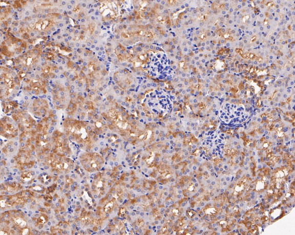 Immunohistochemical analysis of paraffin-embedded mouse kidney tissue using anti-UCHL3 antibody. The section was pre-treated using heat mediated antigen retrieval with Tris-EDTA buffer (pH 8.0-8.4) for 20 minutes.The tissues were blocked in 5% BSA for 30 minutes at room temperature, washed with ddH2O and PBS, and then probed with the primary antibody (ET7111-28, 1/200) for 30 minutes at room temperature. The detection was performed using an HRP conjugated compact polymer system. DAB was used as the chromogen. Tissues were counterstained with hematoxylin and mounted with DPX.