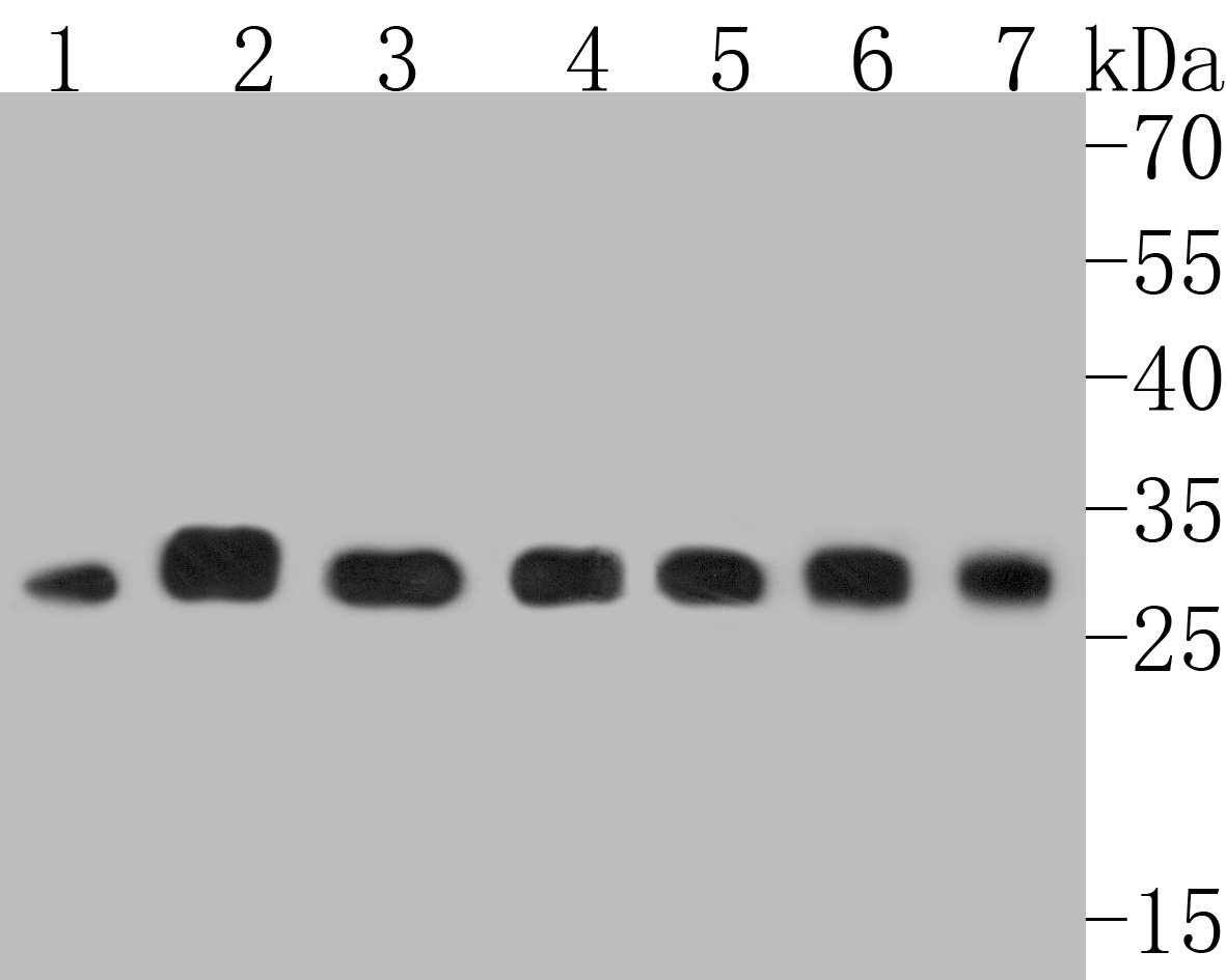 Western blot analysis of MRPL28 on different lysates. Proteins were transferred to a PVDF membrane and blocked with 5% BSA in PBS for 1 hour at room temperature. The primary antibody (ET7111-30, 1/500) was used in 5% BSA at room temperature for 2 hours. Goat Anti-Rabbit IgG - HRP Secondary Antibody (HA1001) at 1:5,000 dilution was used for 1 hour at room temperature.<br />
Positive control: <br />
Lane 1: Mouse liver tissue lysate<br />
Lane 2: SW480 cell lysate<br />
Lane 3: Rat stomach tissue lysate<br />
Lane 4: Human skin tissue lysate<br />
Lane 5: A549 cell lysate<br />
Lane 6: K562 cell lysate<br />
Lane 7: Hela cell lysate