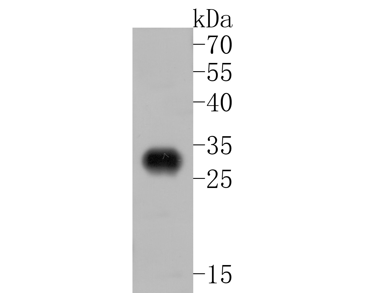 Western blot analysis of MRPL28 on zebrafish tissue lysates. Proteins were transferred to a PVDF membrane and blocked with 5% BSA in PBS for 1 hour at room temperature. The primary antibody (ET7111-30, 1/500) was used in 5% BSA at room temperature for 2 hours. Goat Anti-Rabbit IgG - HRP Secondary Antibody (HA1001) at 1:5,000 dilution was used for 1 hour at room temperature.