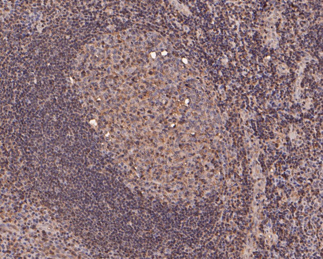 Immunohistochemical analysis of paraffin-embedded human tonsil tissue using anti-MRPL28 antibody. The section was pre-treated using heat mediated antigen retrieval with Tris-EDTA buffer (pH 8.0-8.4) for 20 minutes.The tissues were blocked in 5% BSA for 30 minutes at room temperature, washed with ddH2O and PBS, and then probed with the primary antibody (ET7111-30, 1/50) for 30 minutes at room temperature. The detection was performed using an HRP conjugated compact polymer system. DAB was used as the chromogen. Tissues were counterstained with hematoxylin and mounted with DPX.