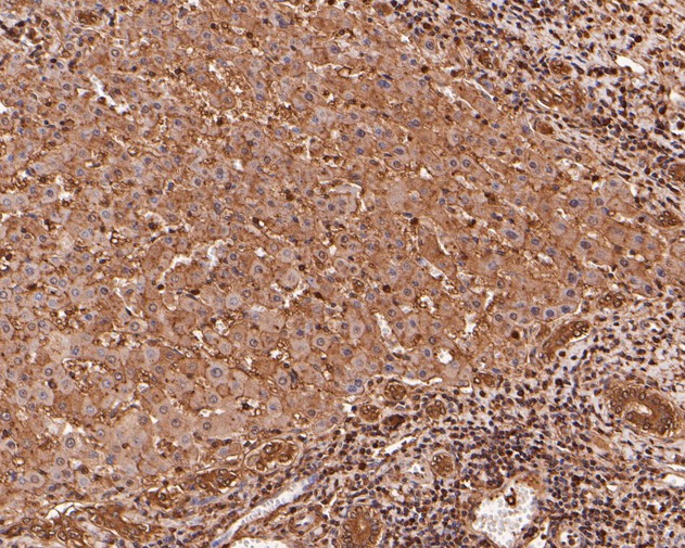 Immunohistochemical analysis of paraffin-embedded human liver tissue using anti-MRPL28 antibody. The section was pre-treated using heat mediated antigen retrieval with Tris-EDTA buffer (pH 8.0-8.4) for 20 minutes.The tissues were blocked in 5% BSA for 30 minutes at room temperature, washed with ddH2O and PBS, and then probed with the primary antibody (ET7111-30, 1/200) for 30 minutes at room temperature. The detection was performed using an HRP conjugated compact polymer system. DAB was used as the chromogen. Tissues were counterstained with hematoxylin and mounted with DPX.