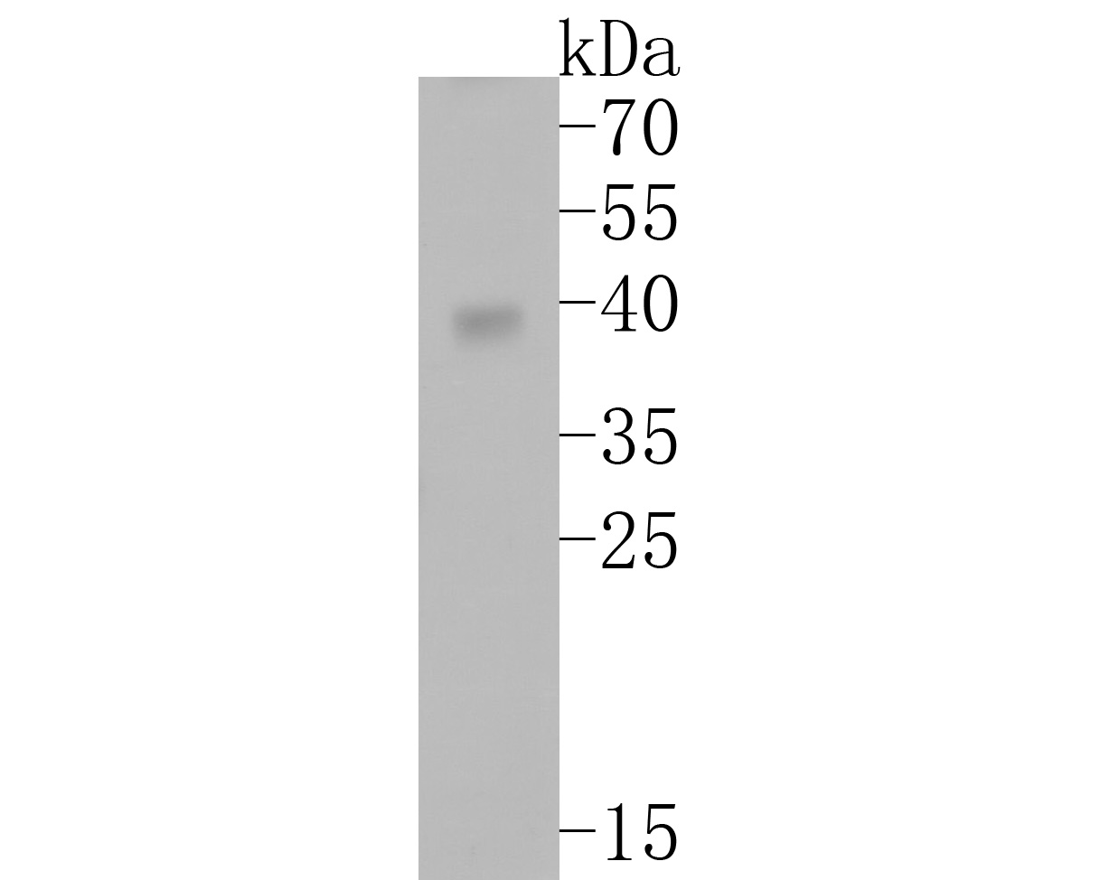Western blot analysis of ALKBH1 on zebrafish tissue lysates. Proteins were transferred to a PVDF membrane and blocked with 5% BSA in PBS for 1 hour at room temperature. The primary antibody (ET7111-31, 1/500) was used in 5% BSA at room temperature for 2 hours. Goat Anti-Rabbit IgG - HRP Secondary Antibody (HA1001) at 1:5,000 dilution was used for 1 hour at room temperature.