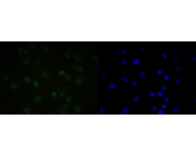 ICC staining of QK1 in A549 cells (green). Formalin fixed cells were permeabilized with 0.1% Triton X-100 in TBS for 10 minutes at room temperature and blocked with 1% Blocker BSA for 15 minutes at room temperature. Cells were probed with the primary antibody (ET7111-32, 1/50) for 1 hour at room temperature, washed with PBS. Alexa Fluor®488 Goat anti-Rabbit IgG was used as the secondary antibody at 1/1,000 dilution. The nuclear counter stain is DAPI (blue).