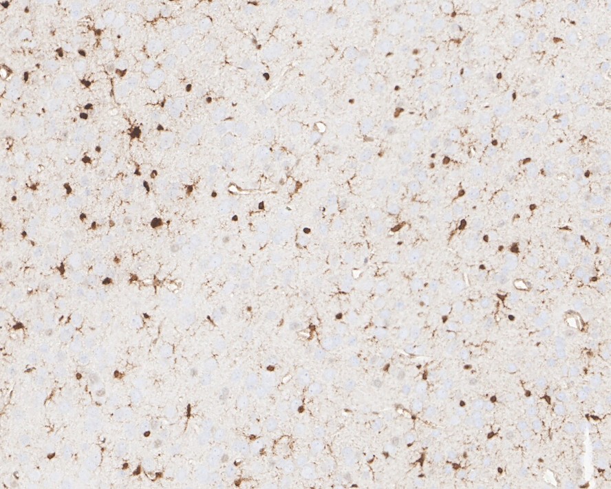 Immunohistochemical analysis of paraffin-embedded mouse brain tissue with Rabbit anti-QK1 antibody (ET7111-32) at 1/1,000 dilution.<br />
<br />
The section was pre-treated using heat mediated antigen retrieval with sodium citrate buffer (pH 6.0) for 2 minutes. The tissues were blocked in 1% BSA for 20 minutes at room temperature, washed with ddH2O and PBS, and then probed with the primary antibody (ET7111-32) at 1/1,000 dilution for 1 hour at room temperature. The detection was performed using an HRP conjugated compact polymer system. DAB was used as the chromogen. Tissues were counterstained with hematoxylin and mounted with DPX.