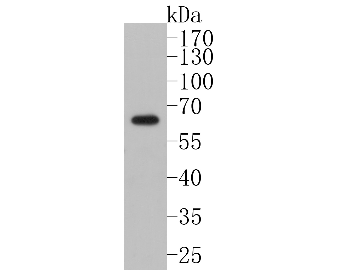 Western blot analysis of PAK1 on HL-60 cell lysates. Proteins were transferred to a PVDF membrane and blocked with 5% BSA in PBS for 1 hour at room temperature. The primary antibody (ET7111-33, 1/500) was used in 5% BSA at room temperature for 2 hours. Goat Anti-Rabbit IgG - HRP Secondary Antibody (HA1001) at 1:5,000 dilution was used for 1 hour at room temperature.