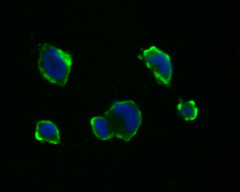 ICC staining of PAK1 in F9 cells (green). Formalin fixed cells were permeabilized with 0.1% Triton X-100 in TBS for 10 minutes at room temperature and blocked with 1% Blocker BSA for 15 minutes at room temperature. Cells were probed with the primary antibody (ET7111-33, 1/50) for 1 hour at room temperature, washed with PBS. Alexa Fluor®488 Goat anti-Rabbit IgG was used as the secondary antibody at 1/1,000 dilution. The nuclear counter stain is DAPI (blue).