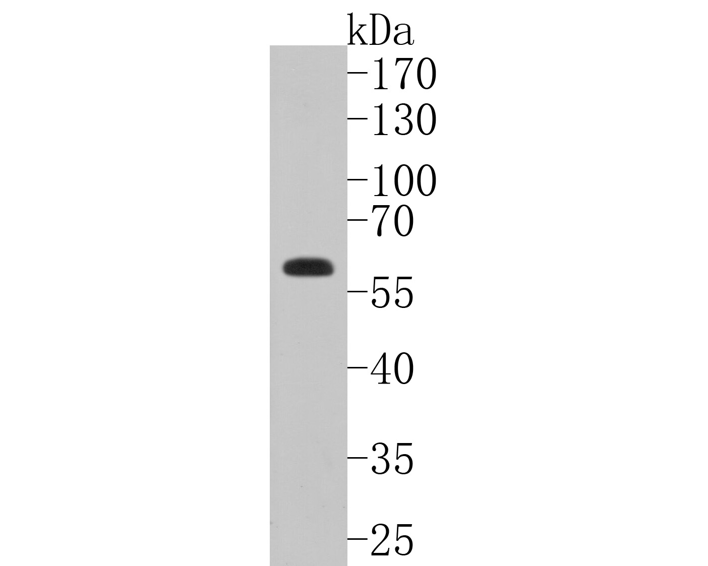 Western blot analysis of EIF2A on A431 cell lysates. Proteins were transferred to a PVDF membrane and blocked with 5% BSA in PBS for 1 hour at room temperature. The primary antibody (ET7111-34, 1/500) was used in 5% BSA at room temperature for 2 hours. Goat Anti-Rabbit IgG - HRP Secondary Antibody (HA1001) at 1:5,000 dilution was used for 1 hour at room temperature.