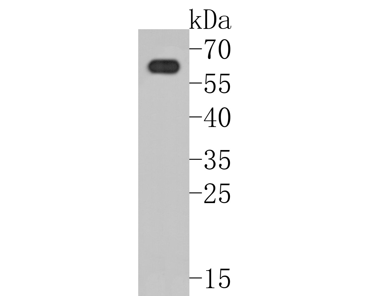 Western blot analysis of PAK3 on rat brain tissue lysates. Proteins were transferred to a PVDF membrane and blocked with 5% BSA in PBS for 1 hour at room temperature. The primary antibody (ET7111-35, 1/500) was used in 5% BSA at room temperature for 2 hours. Goat Anti-Rabbit IgG - HRP Secondary Antibody (HA1001) at 1:5,000 dilution was used for 1 hour at room temperature.