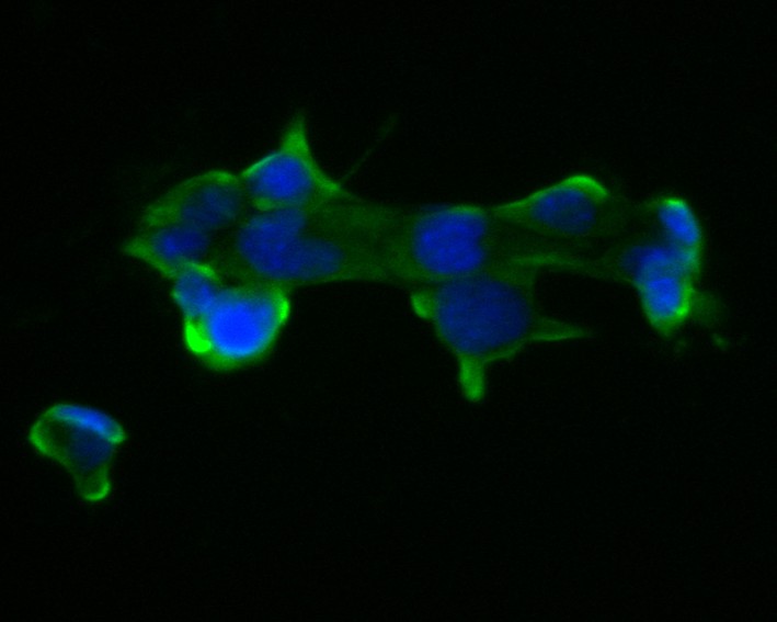 ICC staining of PAK3 in F9 cells (green). Formalin fixed cells were permeabilized with 0.1% Triton X-100 in TBS for 10 minutes at room temperature and blocked with 1% Blocker BSA for 15 minutes at room temperature. Cells were probed with the primary antibody (ET7111-35, 1/50) for 1 hour at room temperature, washed with PBS. Alexa Fluor®488 Goat anti-Rabbit IgG was used as the secondary antibody at 1/1,000 dilution. The nuclear counter stain is DAPI (blue).