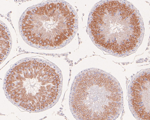 Immunohistochemical analysis of paraffin-embedded rat testis tissue using anti-Calmegin antibody. The section was pre-treated using heat mediated antigen retrieval with Tris-EDTA buffer (pH 8.0-8.4) for 20 minutes.The tissues were blocked in 5% BSA for 30 minutes at room temperature, washed with ddH2O and PBS, and then probed with the primary antibody (ET7111-36, 1/50) for 30 minutes at room temperature. The detection was performed using an HRP conjugated compact polymer system. DAB was used as the chromogen. Tissues were counterstained with hematoxylin and mounted with DPX.