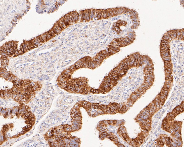 Immunohistochemical analysis of paraffin-embedded human fallopian tube tissue using anti-Calmegin antibody. The section was pre-treated using heat mediated antigen retrieval with Tris-EDTA buffer (pH 8.0-8.4) for 20 minutes.The tissues were blocked in 5% BSA for 30 minutes at room temperature, washed with ddH2O and PBS, and then probed with the primary antibody (ET7111-36, 1/50) for 30 minutes at room temperature. The detection was performed using an HRP conjugated compact polymer system. DAB was used as the chromogen. Tissues were counterstained with hematoxylin and mounted with DPX.