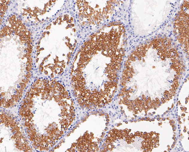 Immunohistochemical analysis of paraffin-embedded mouse testis tissue using anti-Calmegin antibody. The section was pre-treated using heat mediated antigen retrieval with Tris-EDTA buffer (pH 8.0-8.4) for 20 minutes.The tissues were blocked in 5% BSA for 30 minutes at room temperature, washed with ddH2O and PBS, and then probed with the primary antibody (ET7111-36, 1/200) for 30 minutes at room temperature. The detection was performed using an HRP conjugated compact polymer system. DAB was used as the chromogen. Tissues were counterstained with hematoxylin and mounted with DPX.