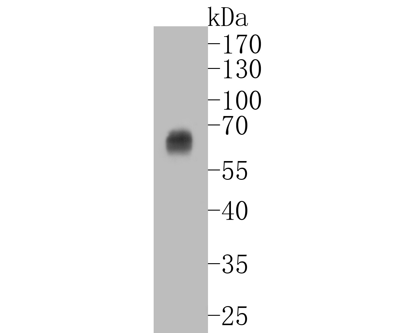 Western blot analysis of Oct-2 on Daudi cell lysates. Proteins were transferred to a PVDF membrane and blocked with 5% BSA in PBS for 1 hour at room temperature. The primary antibody (ET7111-39, 1/500) was used in 5% BSA at room temperature for 2 hours. Goat Anti-Rabbit IgG - HRP Secondary Antibody (HA1001) at 1:5,000 dilution was used for 1 hour at room temperature.