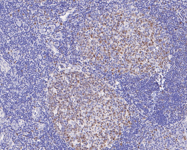 Immunohistochemical analysis of paraffin-embedded human tonsil tissue using anti-Oct-2 antibody. The section was pre-treated using heat mediated antigen retrieval with sodium citrate buffer (pH 6.0) for 20 minutes. The tissues were blocked in 5% BSA for 30 minutes at room temperature, washed with ddH2O and PBS, and then probed with the primary antibody (ET7111-39, 1/50)  for 30 minutes at room temperature. The detection was performed using an HRP conjugated compact polymer system. DAB was used as the chromogen. Tissues were counterstained with hematoxylin and mounted with DPX.