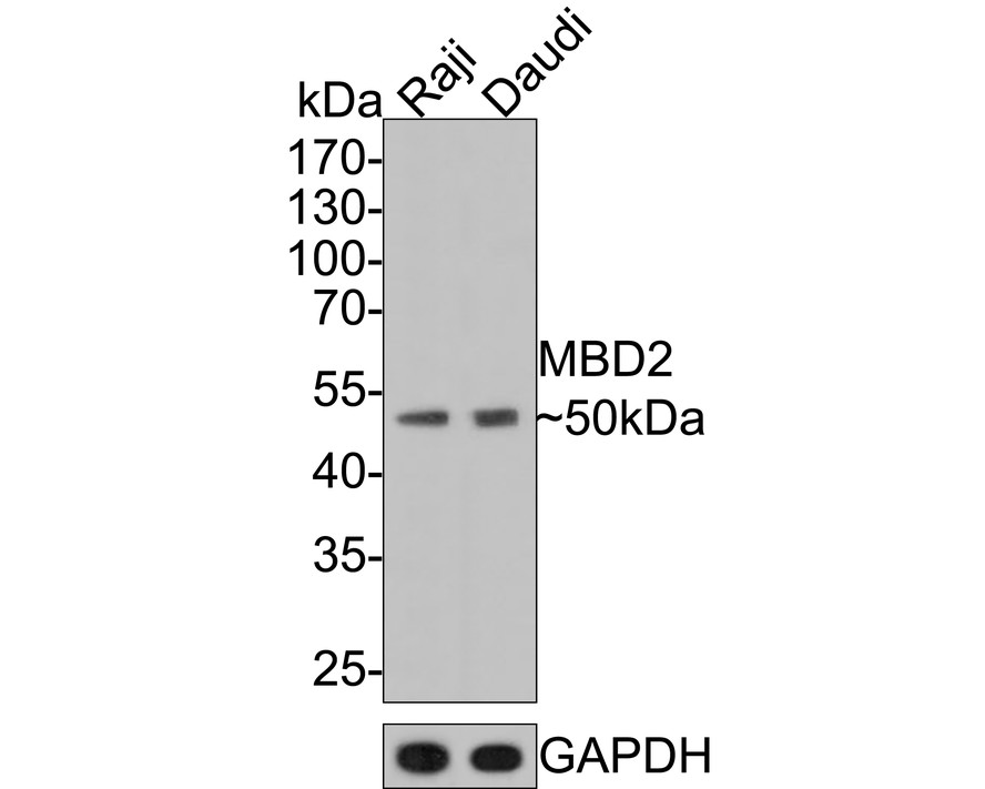 Western blot analysis of MBD2 on different lysates with Rabbit anti-MBD2 antibody (ET7111-40) at 1/500 dilution.<br />
<br />
Lane 1: Raji cell lysate<br />
Lane 2: Daudi cell lysate<br />
<br />
Lysates/proteins at 10 µg/Lane.<br />
<br />
Predicted band size: 43 kDa<br />
Observed band size: 50 kDa<br />
<br />
Exposure time: 2 minutes;<br />
<br />
10% SDS-PAGE gel.<br />
<br />
Proteins were transferred to a PVDF membrane and blocked with 5% NFDM/TBST for 1 hour at room temperature. The primary antibody (ET7111-40) at 1/500 dilution was used in 5% NFDM/TBST at room temperature for 2 hours. Goat Anti-Rabbit IgG - HRP Secondary Antibody (HA1001) at 1:200,000 dilution was used for 1 hour at room temperature.