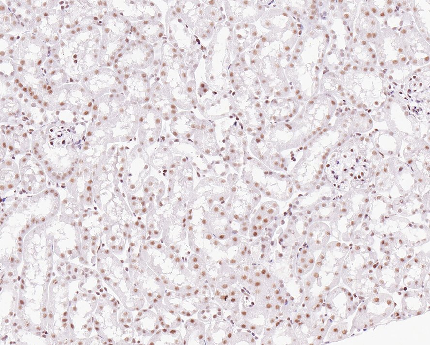 Immunohistochemical analysis of paraffin-embedded mouse kidney tissue with Rabbit anti-MBD2 antibody (ET7111-40) at 1/1,000 dilution.<br />
<br />
The section was pre-treated using heat mediated antigen retrieval with sodium citrate buffer (pH 6.0) for 2 minutes. The tissues were blocked in 1% BSA for 20 minutes at room temperature, washed with ddH2O and PBS, and then probed with the primary antibody (ET7111-40) at 1/1,000 dilution for 1 hour at room temperature. The detection was performed using an HRP conjugated compact polymer system. DAB was used as the chromogen. Tissues were counterstained with hematoxylin and mounted with DPX.