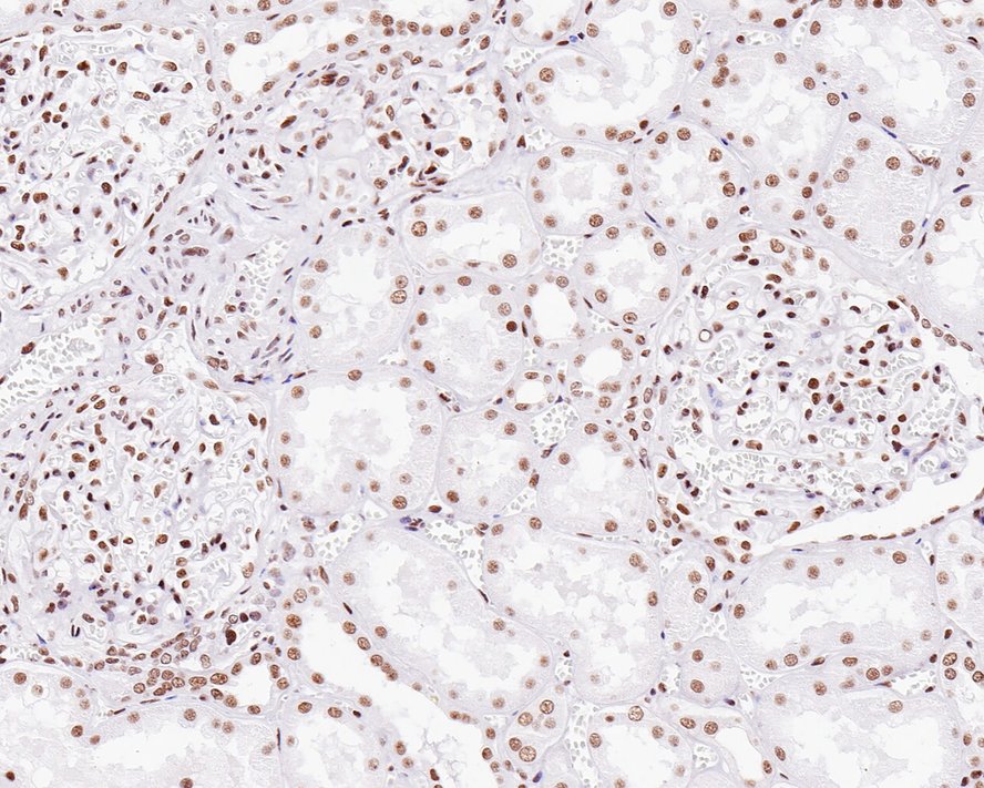 Immunohistochemical analysis of paraffin-embedded human kidney tissue with Rabbit anti-MBD2 antibody (ET7111-40) at 1/200 dilution.<br />
<br />
The section was pre-treated using heat mediated antigen retrieval with sodium citrate buffer (pH 6.0) for 2 minutes. The tissues were blocked in 1% BSA for 20 minutes at room temperature, washed with ddH2O and PBS, and then probed with the primary antibody (ET7111-40) at 1/200 dilution for 1 hour at room temperature. The detection was performed using an HRP conjugated compact polymer system. DAB was used as the chromogen. Tissues were counterstained with hematoxylin and mounted with DPX.